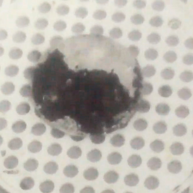 The Bad Side (Reverse) of the coin in round one of the ultrasonic coin cleaning process